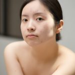 Woman with acne-prone skin showing blemishes and redness — ORY Skincare clarifying and soothing solutions for breakout-prone skin.