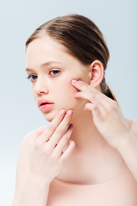 Young woman with acne-prone skin examining blemishes — ORY Skincare solutions for breakouts, redness, and congested pores.